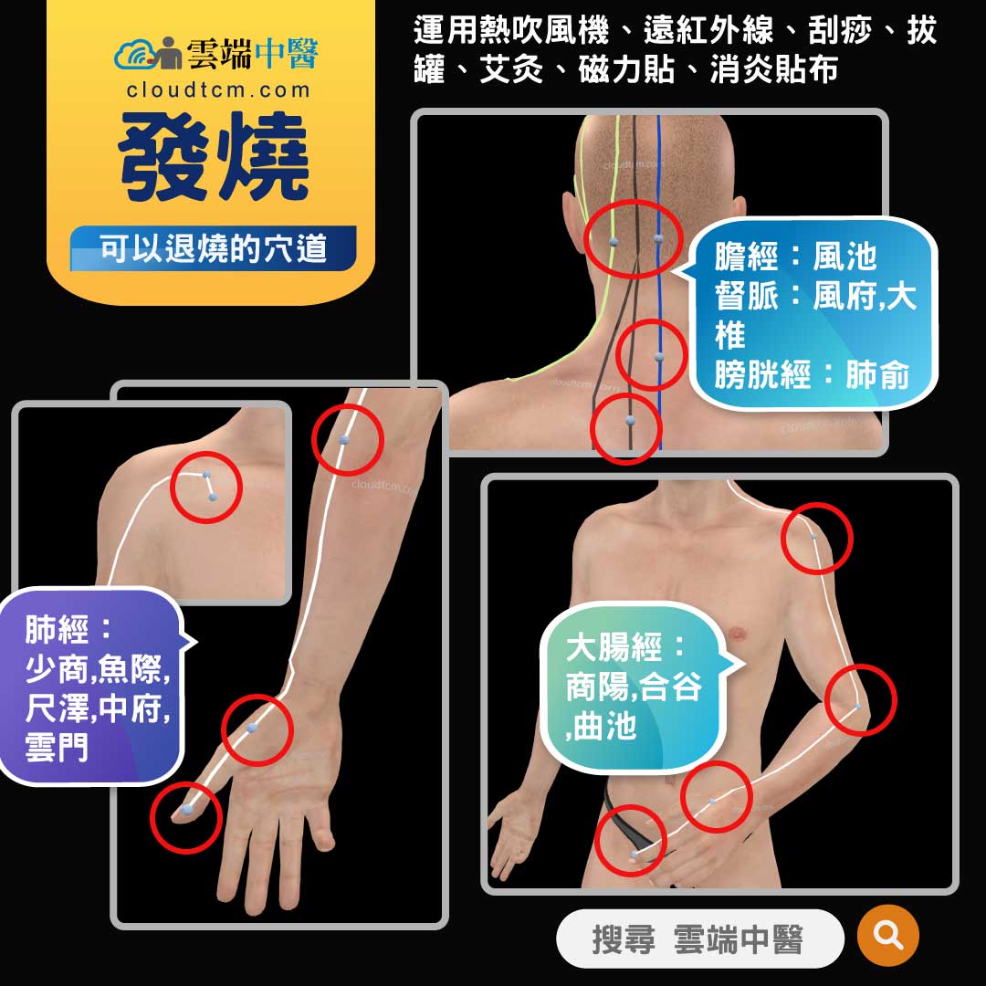 發燒該如何退燒？運用中醫經絡與中藥效果真好！