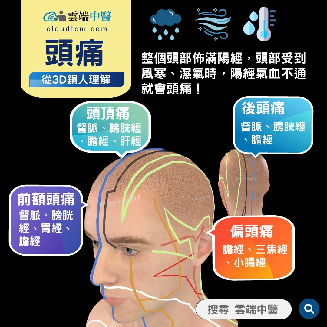偏頭痛真痛苦!從中醫證候,經絡激痛點與中藥理解!